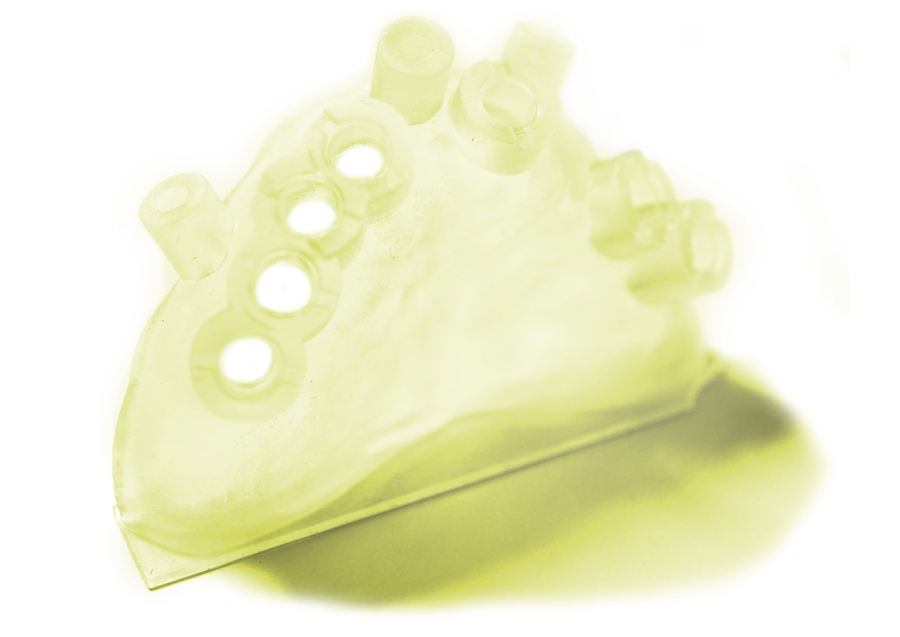 Dental model manufactured with HARZ Labs Dental Yellow Clear Resin